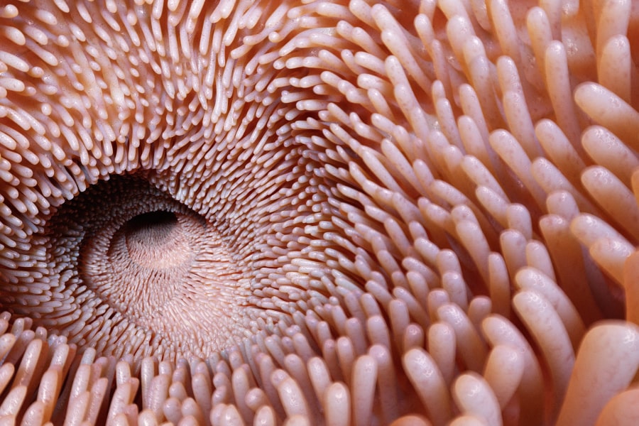 SIBO Die-Off Symptoms