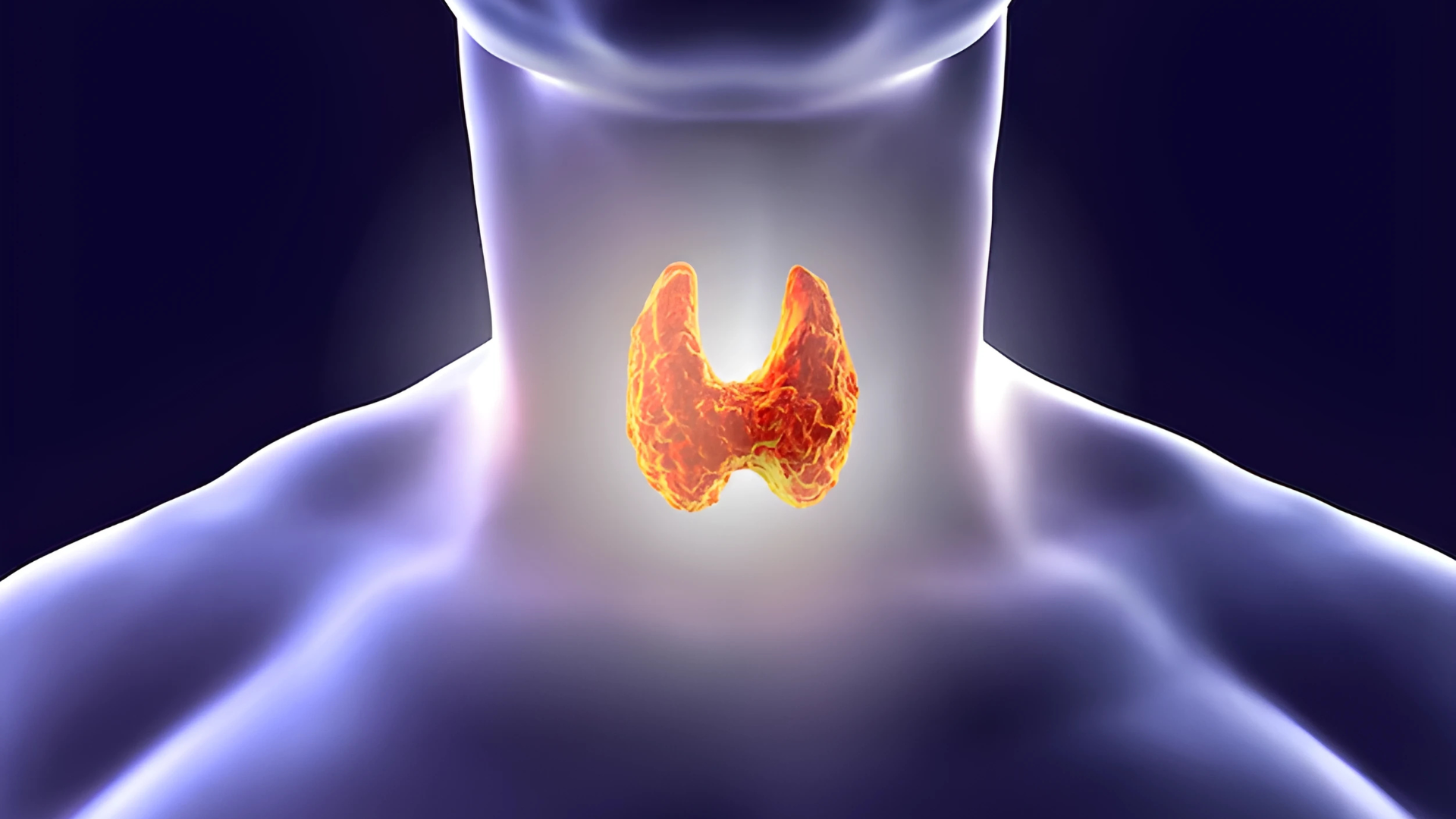 Hashimoto’s Flare Up