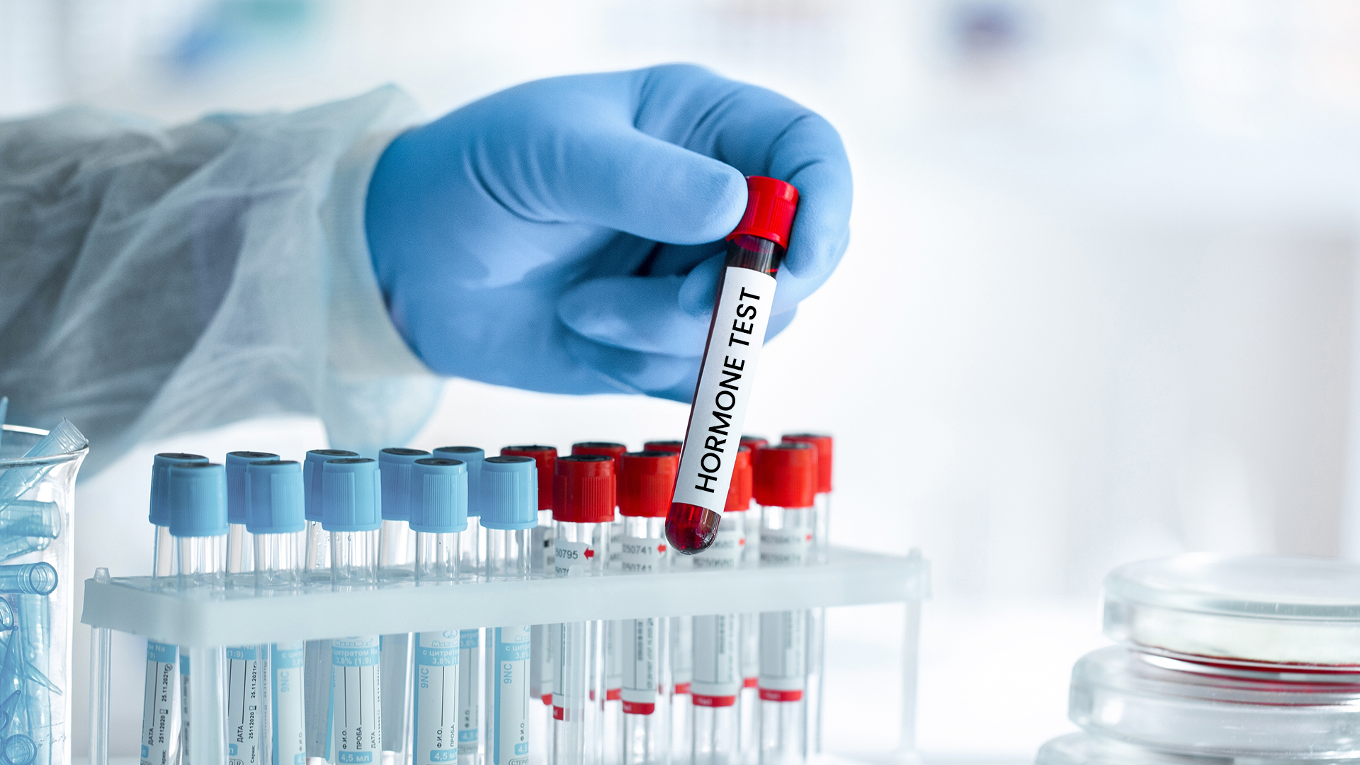 Top 5 Hormone Testing You Should Consider In Functional Medicine