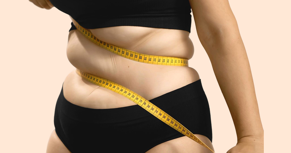 PCOS Belly Is So Difficult to Lose